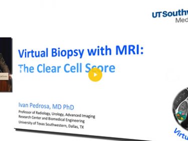 IKCS 2019-Ivan Pedrosa-Virtual biopsy with MRI